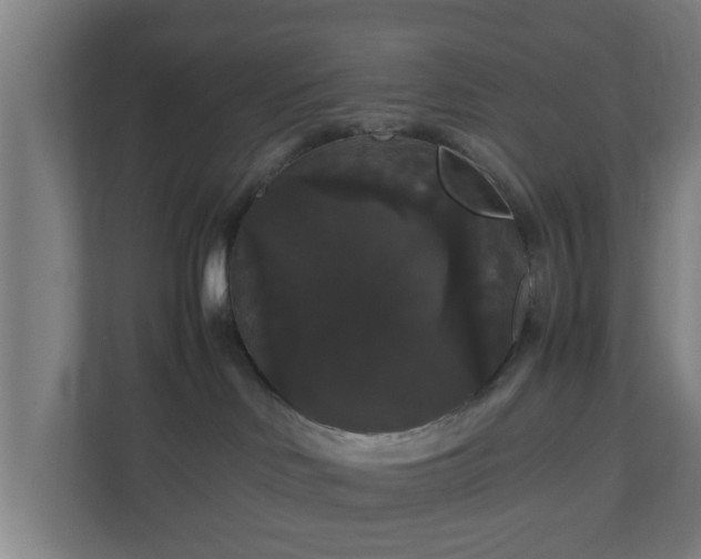 X0000111120046200907071006