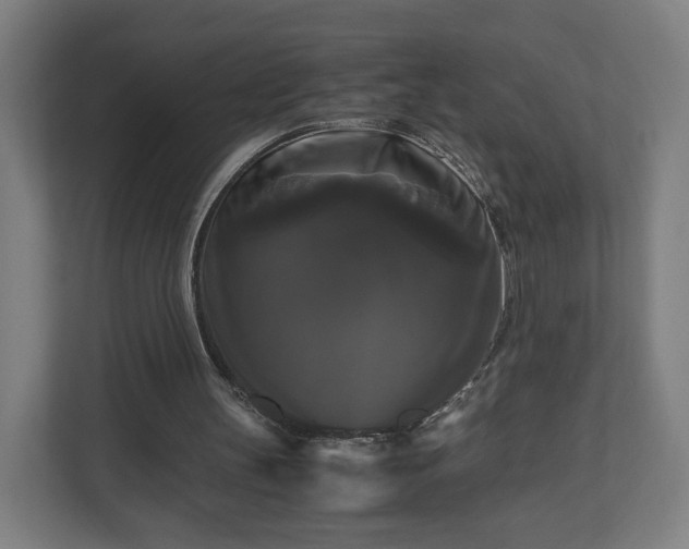 X0000111120147200907071004