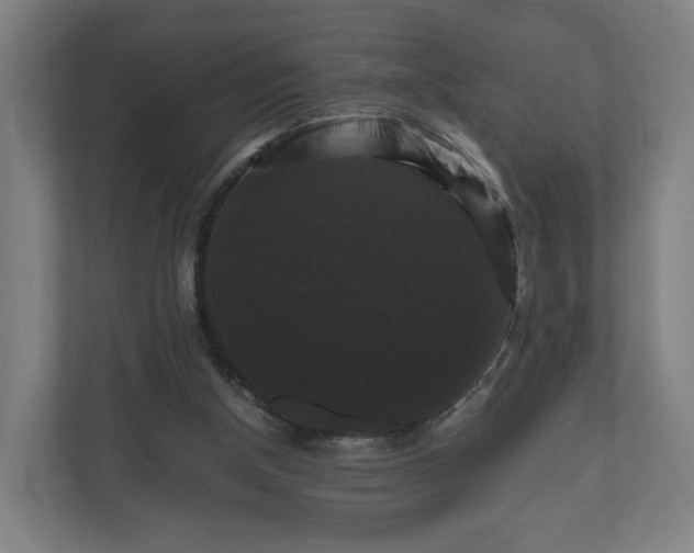 X0000111120154200907071004