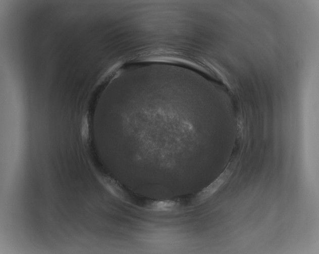 X0000111120158200907071004