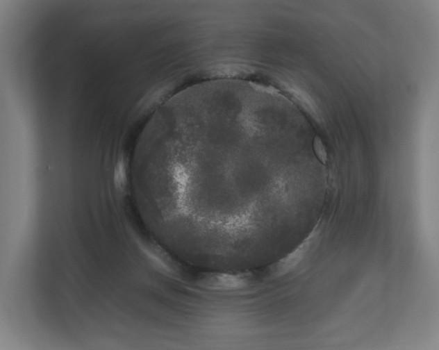 X0000111120166200907071005