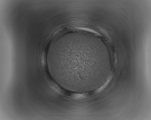 X0000111120170200907071005