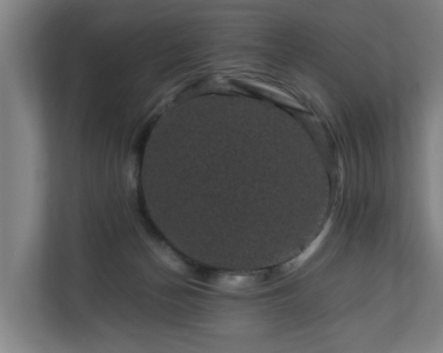 X0000111120174200907071005