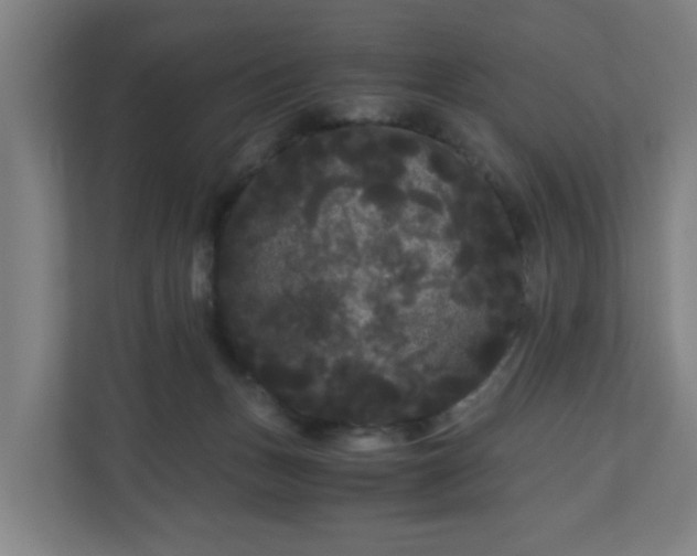 X0000111120175200907071005