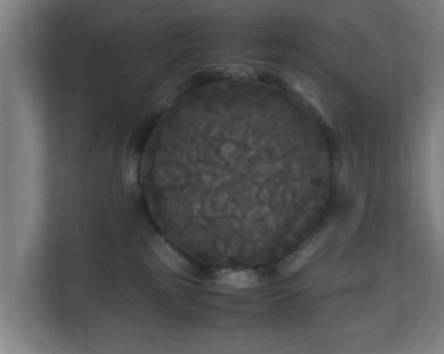 X0000111120185200907071005