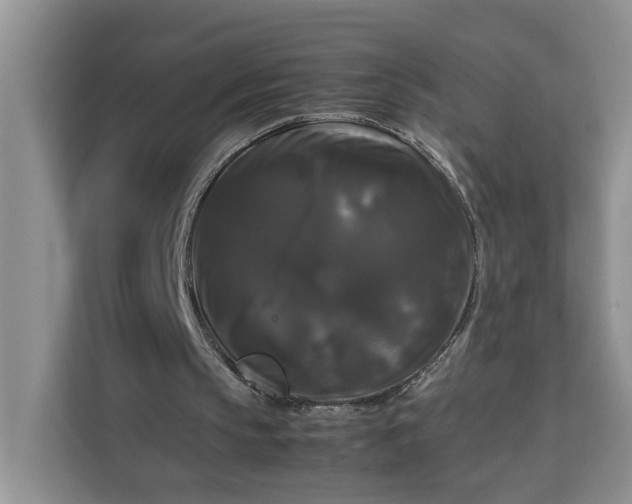 X0000111120145200907141157