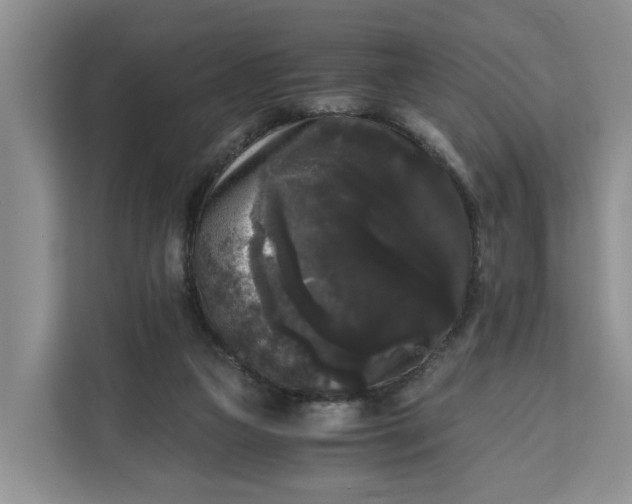 X0000111120161200907141158