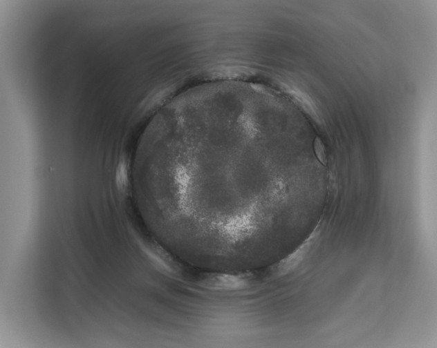 X0000111120166200907141158