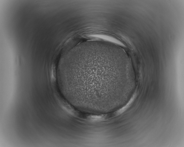 X0000111120170200907141158