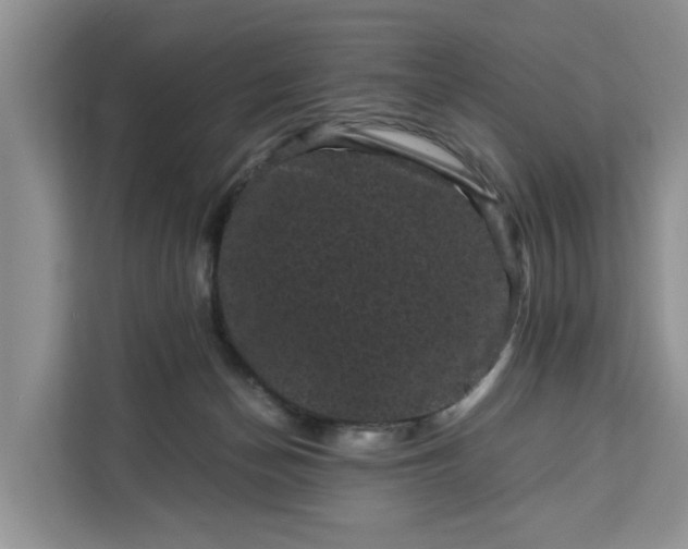 X0000111120174200907141158