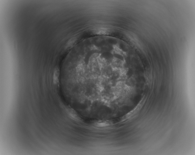 X0000111120175200907141158