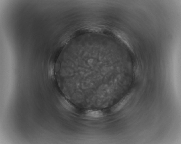 X0000111120185200907141158