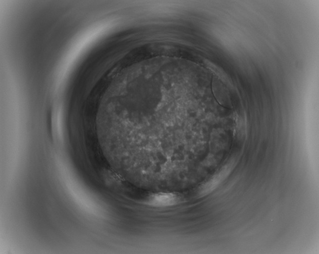 X0000111120189200907141158