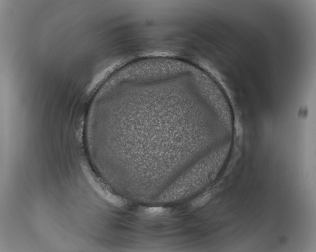 X0000111120153200907211058