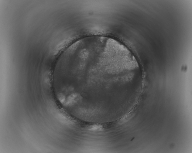 X0000111120162200907211058