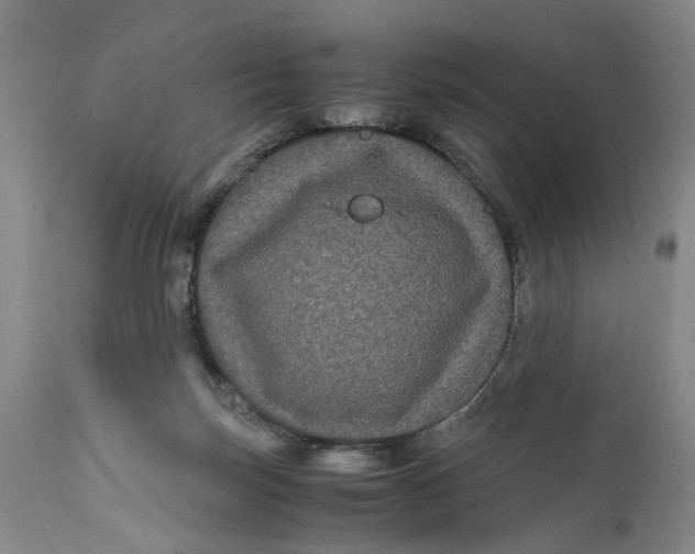 X0000111120171200907211058