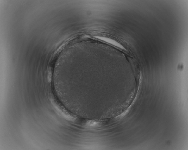 X0000111120174200907211058