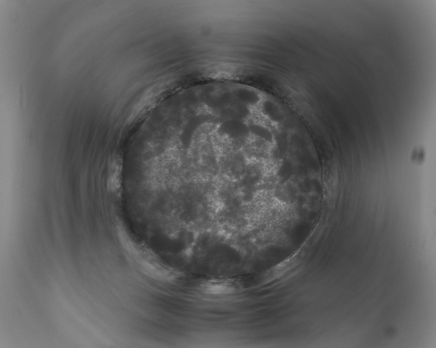 X0000111120175200907211058