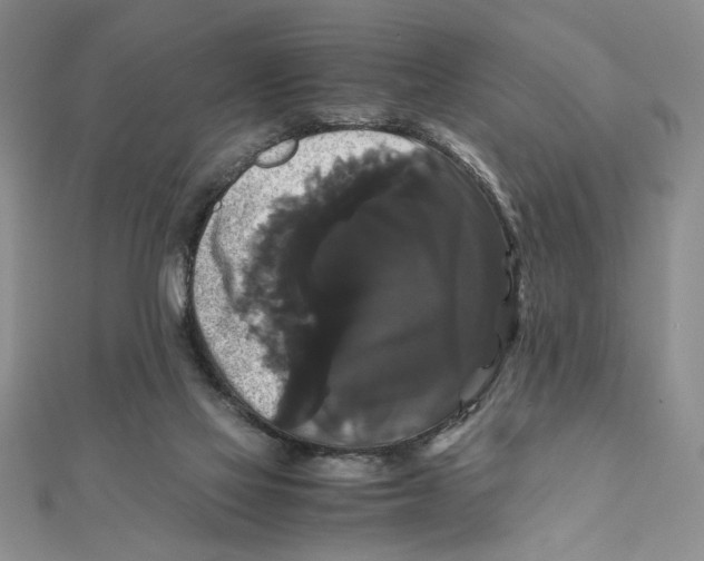 X0000111120069200907281038