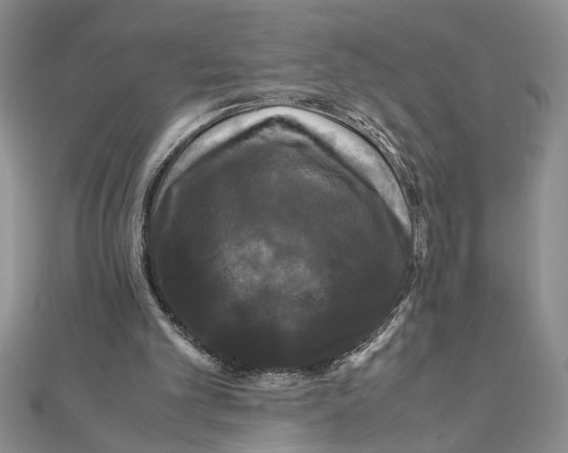 X0000111120101200907281038