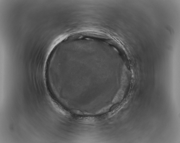 X0000111120104200907281038