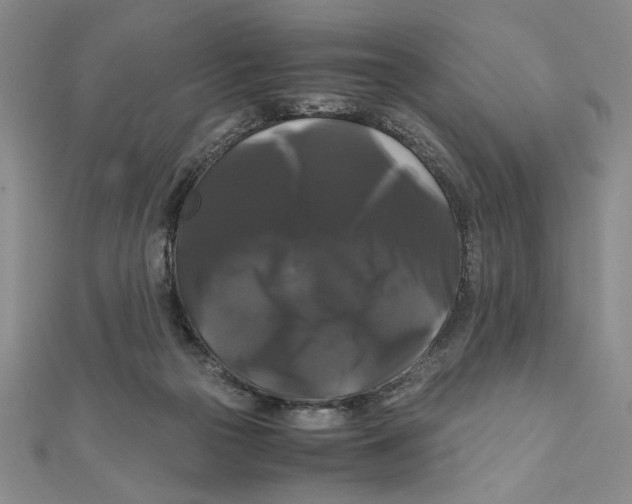X0000111120169200907281037