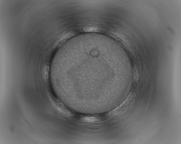 X0000111120171200907281037