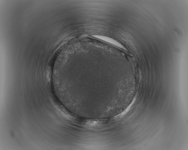 X0000111120174200907281037