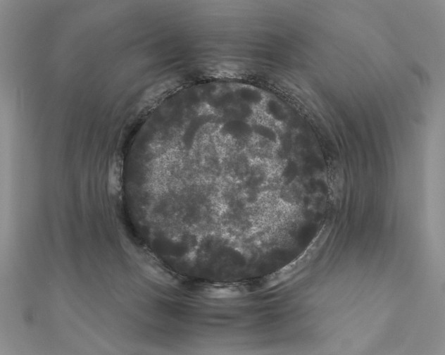 X0000111120175200907281037