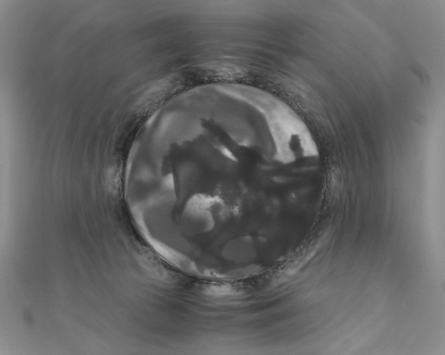 X0000111120177200907281037