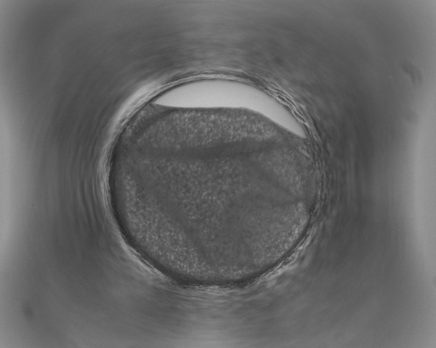 X0000111120197200907281036