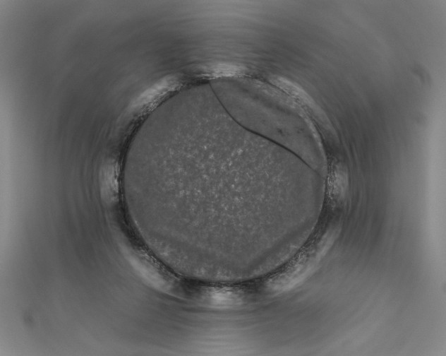 X0000111120264200907281035
