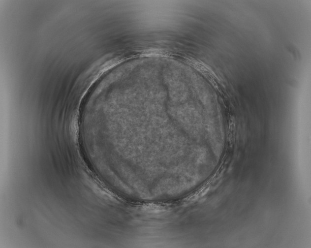 X0000111120290200907281035