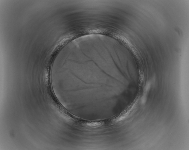 X0000111120357200907281034