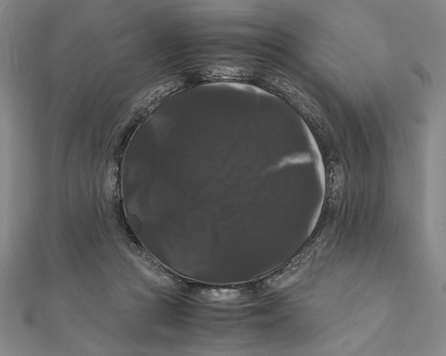 X0000111120361200907281034