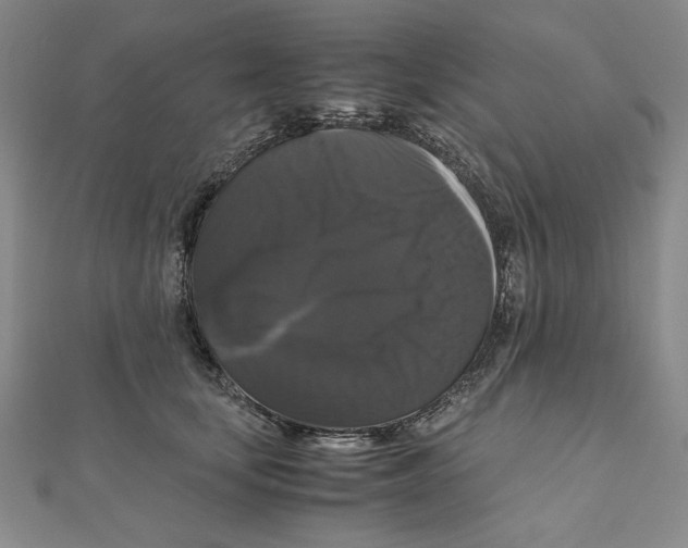 X0000111120659200907281030
