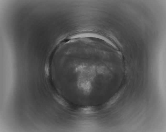 X0000111120068200908111027