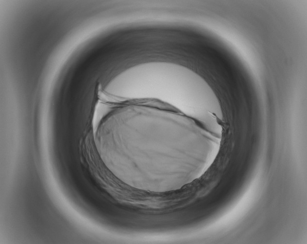 X0000111120143200908111026