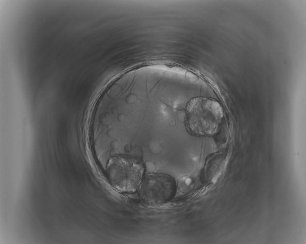 X0000111120145200908111026