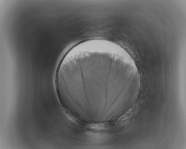X0000111120147200908111026