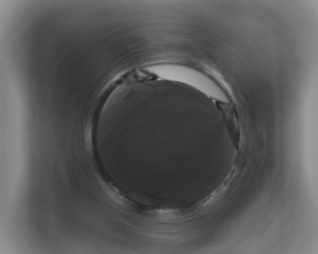 X0000111120154200908111026