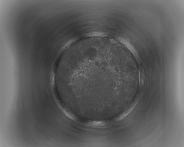 X0000111120157200908111026