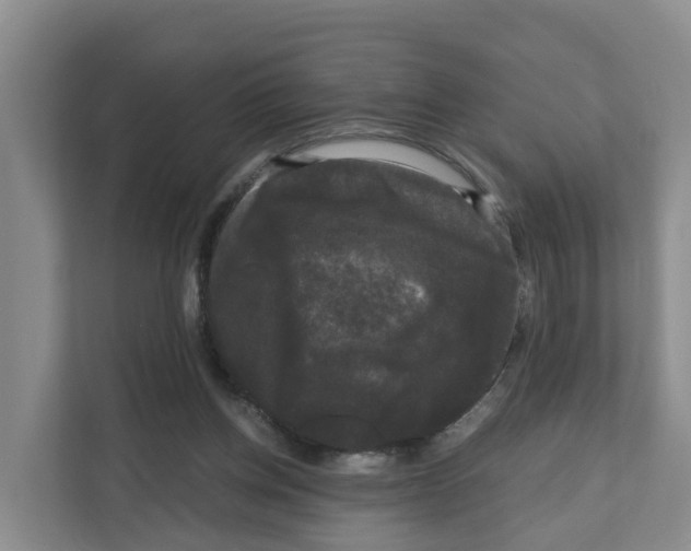 X0000111120158200908111026