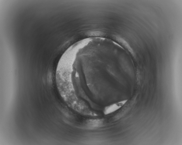 X0000111120161200908111026