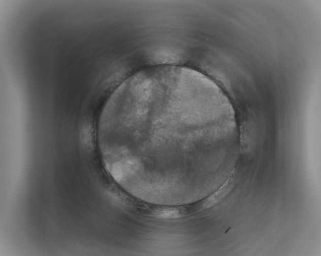 X0000111120162200908111026