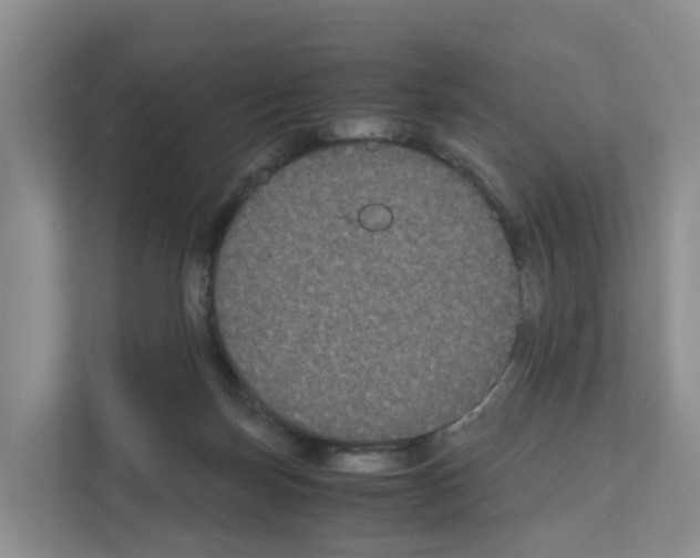 X0000111120171200908111026