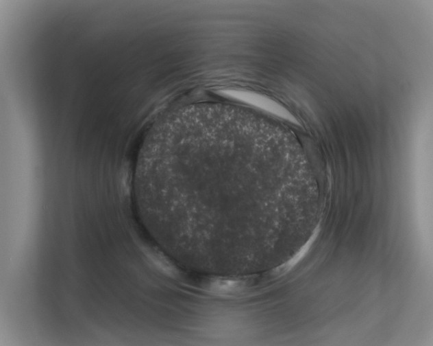 X0000111120174200908111026