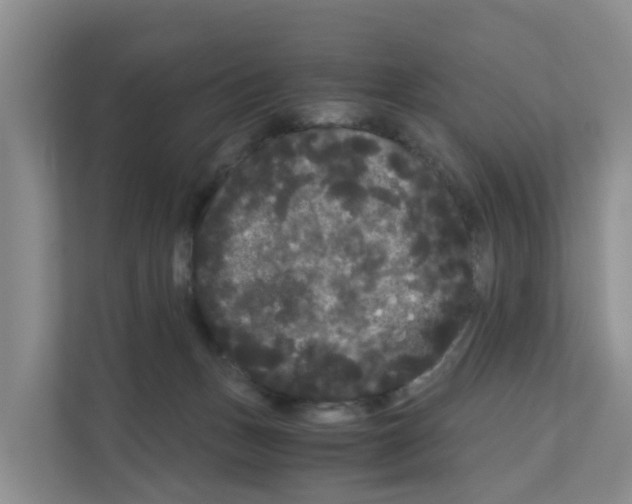 X0000111120175200908111026