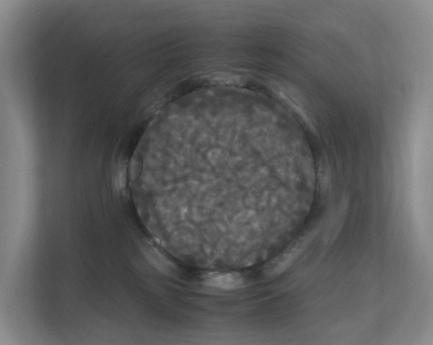 X0000111120185200908111026