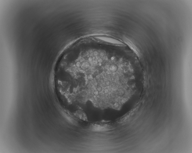 X0000111120346200908111023